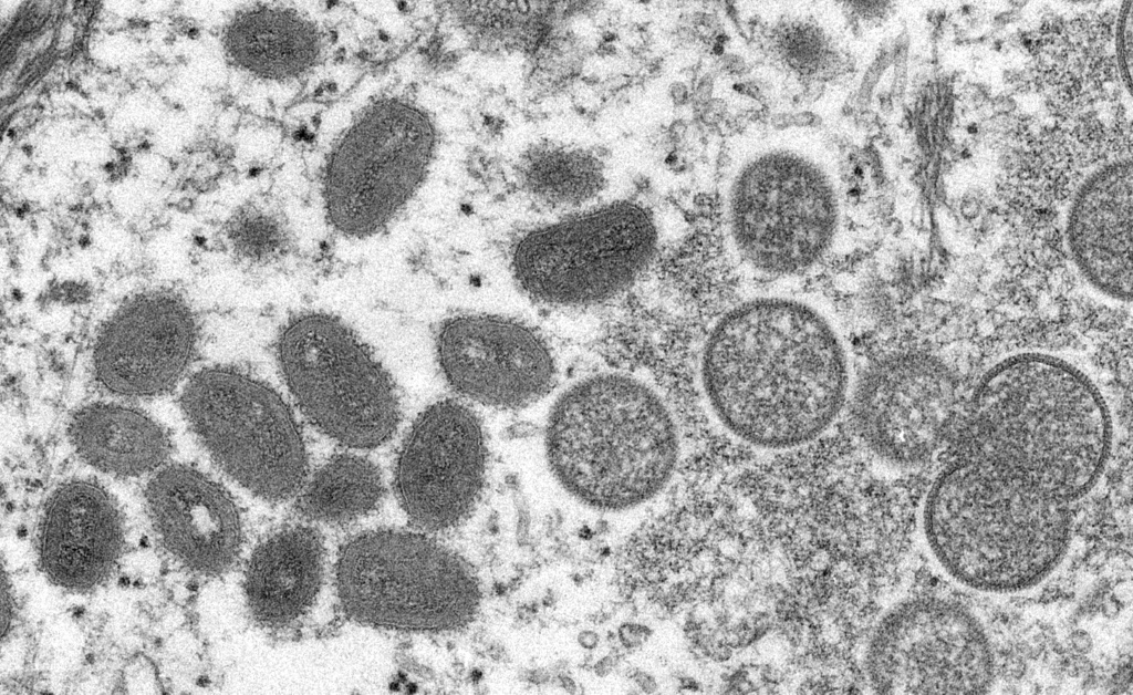 صورة مجهرية من المراكز الأميركية للسيطرة على الأمراض، تظهر فيروس جدري القردة أخذ من عينة سريرية مرتبطة بتفش في عام 2003 (ا ف ب)
