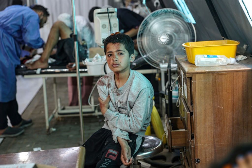 فتى فلسطيني جريح ينتظر العلاج في المستشفى الكويتي بعد الغارات الإسرائيلية على رفح بجنوب قطاع غزة في 7 أيار/مايو 2024 (ا ف ب)