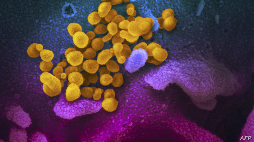 صورة من ميكرسكوب في معاهد الصحة الوطنية في الولايات المتحدة تظهر خلايا فيروس كورنا المستجد (باللون الأصفر) 