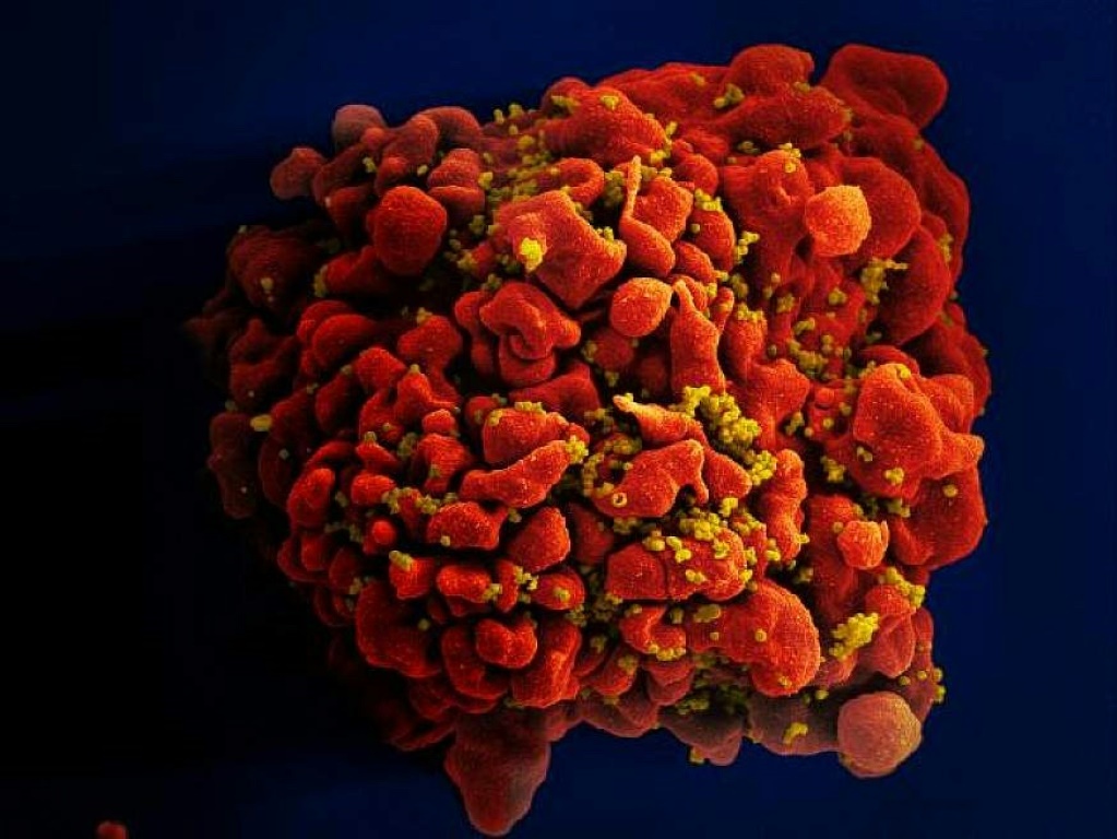 خلية دم بشرية بيضاء مصابة بفيروس نفص المناعة البشرية (ا ف ب)