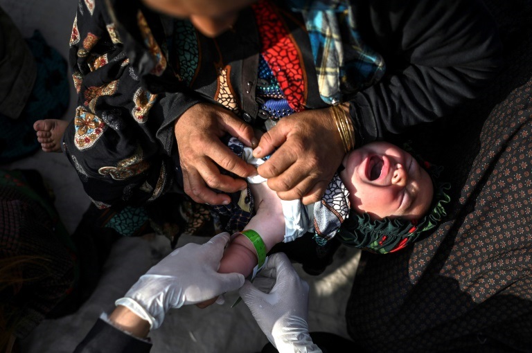 موظفة من منظمة "أطباء بلا حدود" تتحقق من مؤشرات سوء التغذية لدى طفل في مخيم نازحين في ضاحية هرات في 22 تشرين الثاني/نوفمبر 2021 ( ا ف ب)
