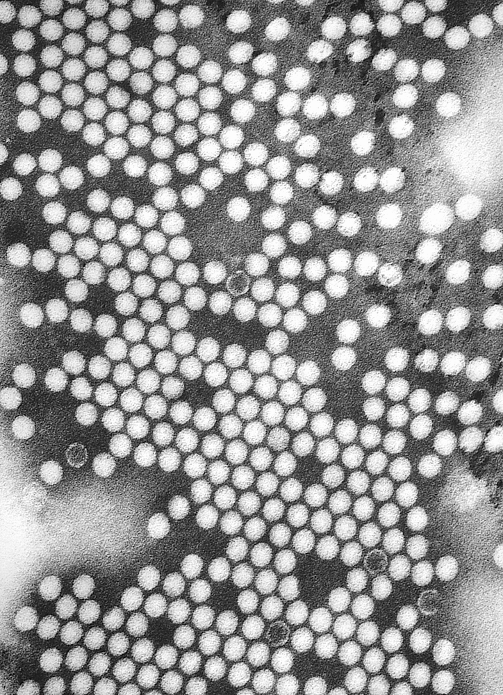  صورة مجهرية بواسطة مجهر إلكتروني نافذ للفيروسة السنجابية (ويكيبيديا)