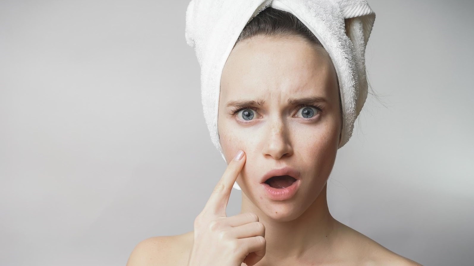 أطعمة متهمة بظهور حب الشباب.. انتبهي إليها(زهرة الخليج)