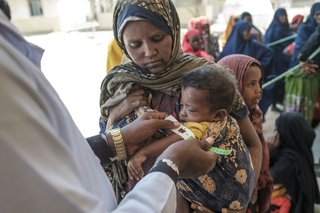 طفل يعاني من سوء التغذية في اثيوبيا في 6 نيسان/ابريل 2022 (ا ف ب)