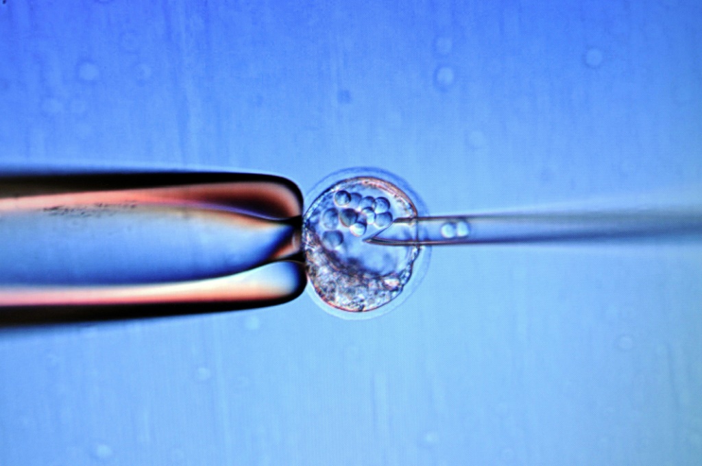     حقن خلايا جذعية لدى جنين فأر لتغيير السلالة الجينية لديه داخل مختبر في مدينة مرسيليا الفرنسية في التاسع من شباط/فبراير 2012 (أ ف ب)   