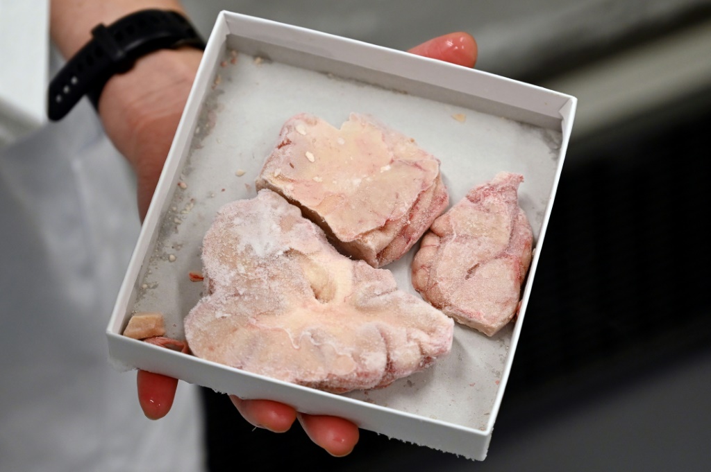 علبة تحوي أجزاء من دماغ بشري في أحد مختبرات كوبنهاغن بتاريخ الثالث من شباط/فبراير 2023 (ا ف ب)