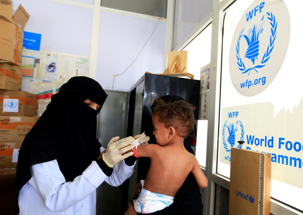 طفل يعاني من سوء التغذية يتلقى العلاج الذي يوفره برنامج الأغذية العالمي في صنعاء، في 22 حزيران/يونيو 2019 (ا ف ب)