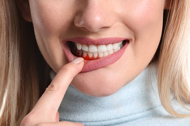  علامات خطرة في الأسنان.. لا تتجاهلها أبداً(الاسرة)