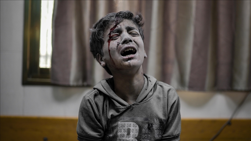 "عالمه مظلم ونصف جسده محروق".. يونيسف تصف الغزي "سهيل" (الأناضول)