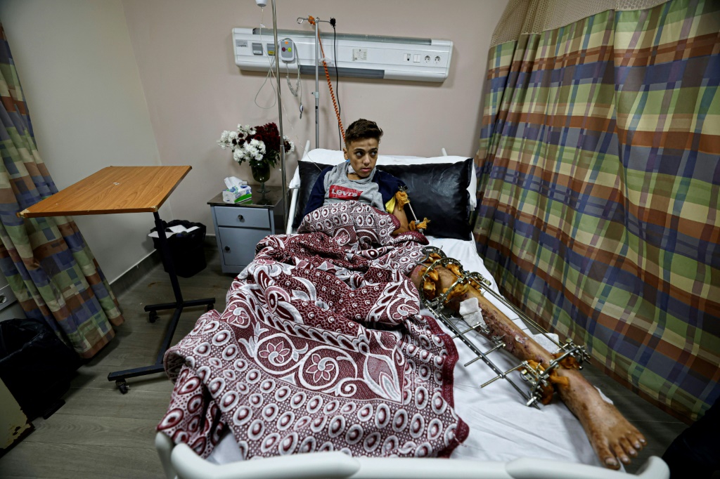 طفل فلطسيني يدعى يوسف يبلغ 13 عاما يتلقى العلاج الطبي في مستشفى ناصر في القاهرة في الثالث من كانون الأول/ديسمبر 2023 من إصابة لحقت به خلال القصف على قطاع غزة (أ ف ب)   