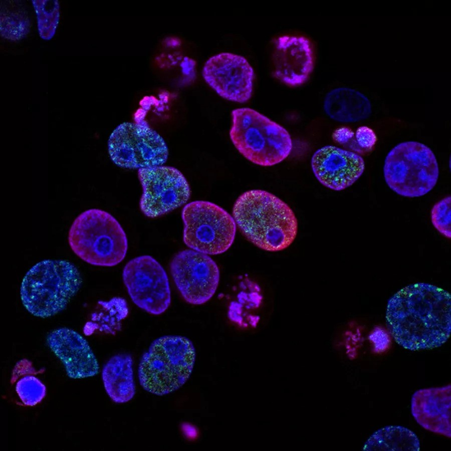 علاج خلايا سرطان القولون والمستقيم البشرية بمثبط التوبويزوميراز ومثبط بروتين كيناز (سبوتنيك)
