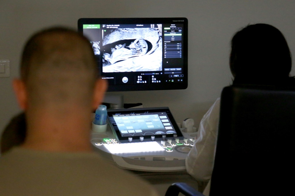 طبيب نسائي يجري فحصاً بالموجات فوق الصوتية لامرأة حامل برفقة زوجها في 13 كانون الأول/ديسمبر 2023 في تيرانا، عاصمة ألبانيا (ا ف ب)