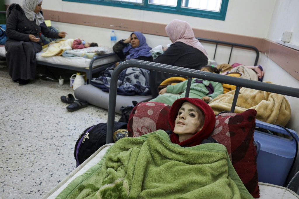 الطفل الفلسطيني يزن الكفارنة (10 سنوات) النازح من بيت حانون يرقد في مستشفى في رفع بجنوب قطاع غزة في 29 شباط/فبراير 2024. توفي يزن في 4 آذار/مارس 2024 جراء سوء التغذية الحاد وعدم توفر الأدوية اللازمة (ا ف ب)