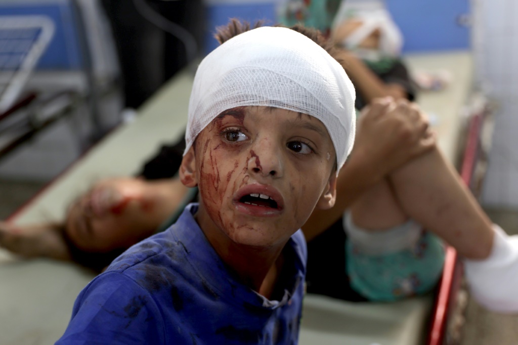 طفل فلسطيني أصيب في القصف الإسرائيلي على أحد أحياء مدينة غزة، في المستشفى الأهلي العربي، المعروف أيضًا باسم المستشفى المعمداني في مدينة غزة، في 4 تموز/يوليو 2024 (ا ف ب)   