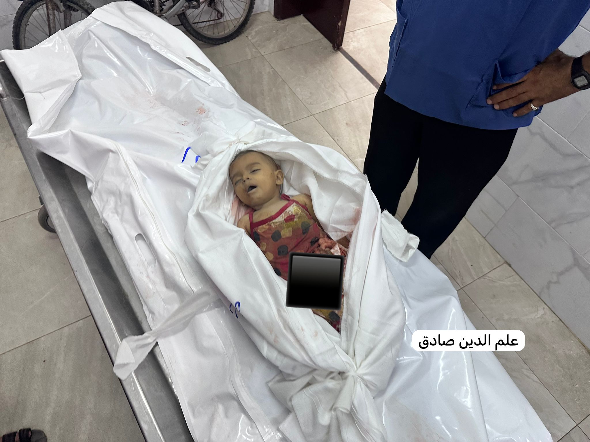 الارهاب الاسرائيلي يقتل الأطفال بعدوان مقصود (x)
