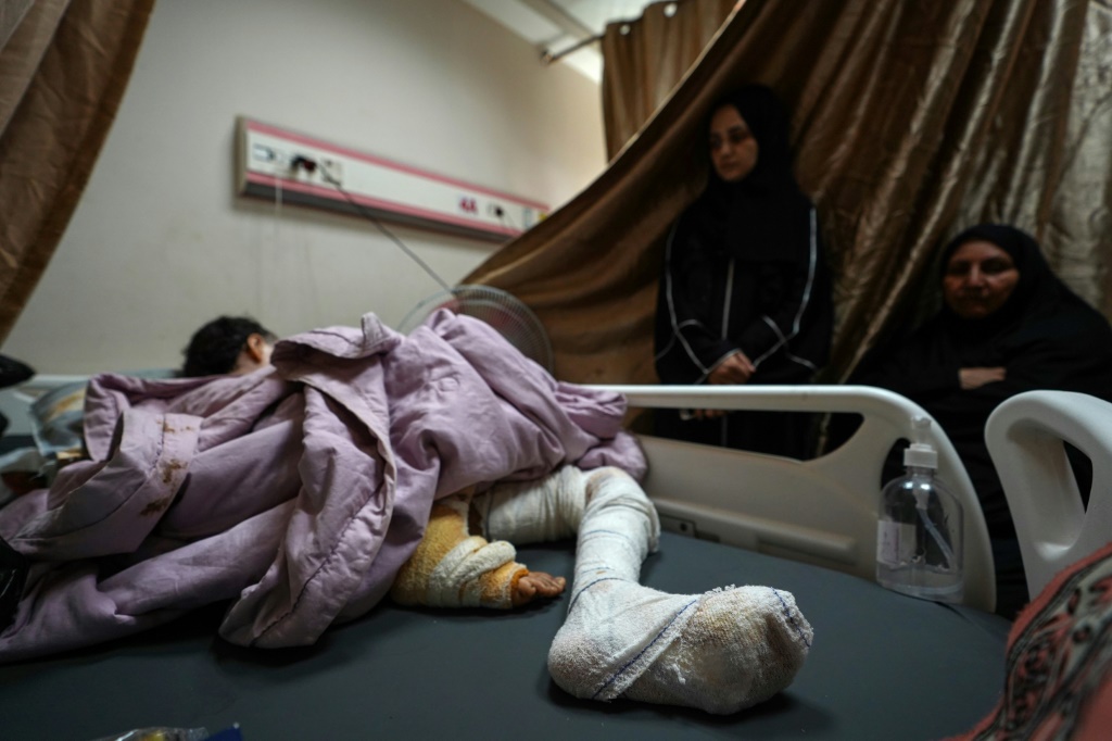 فتاة فلسطينية أصيبت بقصف إسرائيلي وسط قطاع غزة تتلقى العلاج في مستشفى شهداء الأقصى بدير البلح (أ ف ب)   