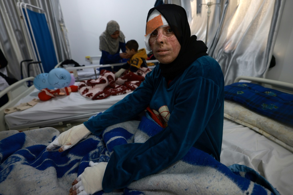 كانت حصيلة العدوان الإسرائيلي المتواصل على غزة، منذ السابع من أكتوبر الماضي، قد وصلت حتى الآن إلى 40 ألفا و534 شهيدا، و93 ألفا و778 جريحا (أ ف ب)