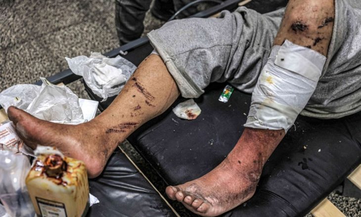 السجون الإسرائيلية تستخدم مرض الجرب الجلدي “أداة لتعذيب” معتقلين فلسطينيين (الأناضول)