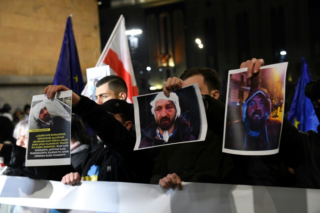 متظاهرون مناهضون للحكومة يحملون صور زملائهم المتظاهرين الذين أصيبوا في الضرب المزعوم من قبل الشرطة (أ ف ب)   