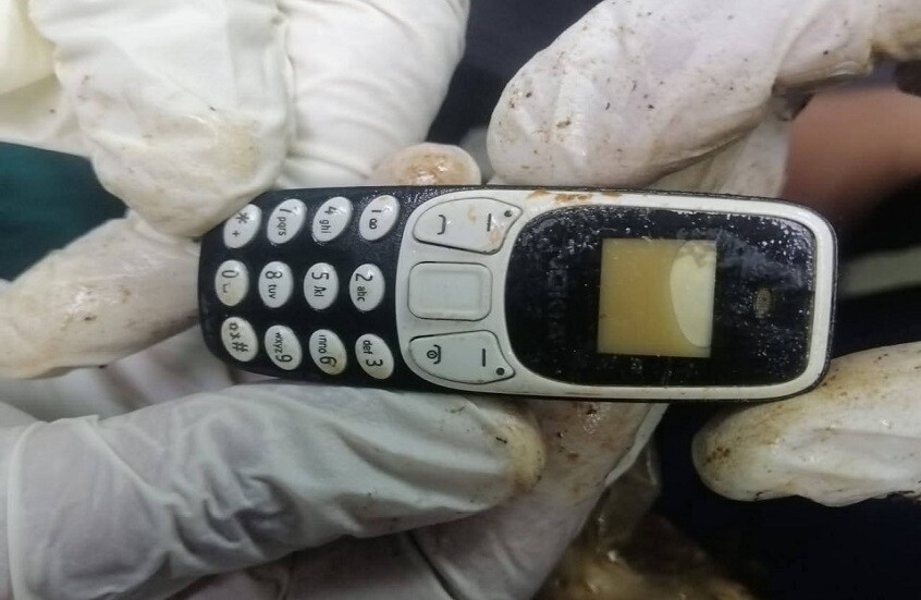 في واقعة نادرة.. استخراج هاتف محمول من بطن شاب مصري بعد عامين من ابتلاعه (روسيا اليوم)