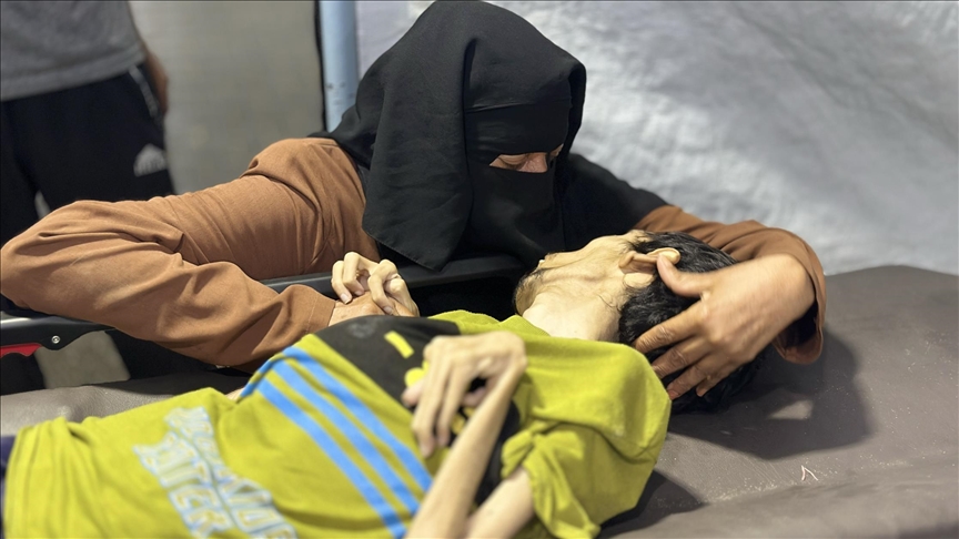 جراء التجويع الإسرائيلي.. وفاة شاب بسوء التغذية في غزة (الأناضول)