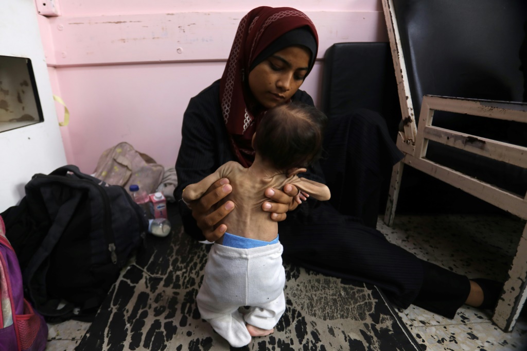 والدة ورضيعها الذي يعاني من سوء التغذية في مستشفى ناصر في خان يونس في جنوب قطاع غزة، في 24 تموز/يوليو 2025 (أ ف ب)