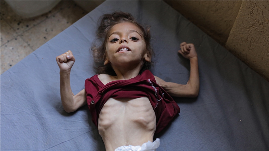 غزة تموت جوعا.. التجويع الإسرائيلي يقتل 6 فلسطينيين خلال 24 ساعة (الأناضول)
