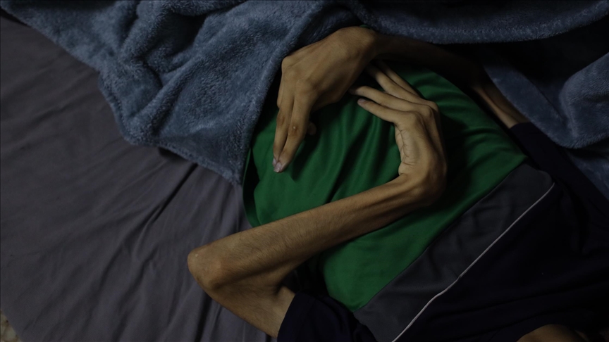 غزة.. ارتفاع حصيلة وفيات التجويع الإسرائيلي إلى 376 فلسطينيا (الأناضول)