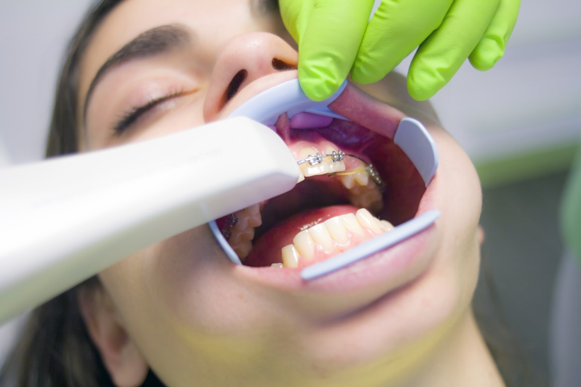 أعراض بسيطة لكنها خطيرة.. متى يجب مراجعة أخصائي تقويم الأسنان؟ (أونسبلاش)