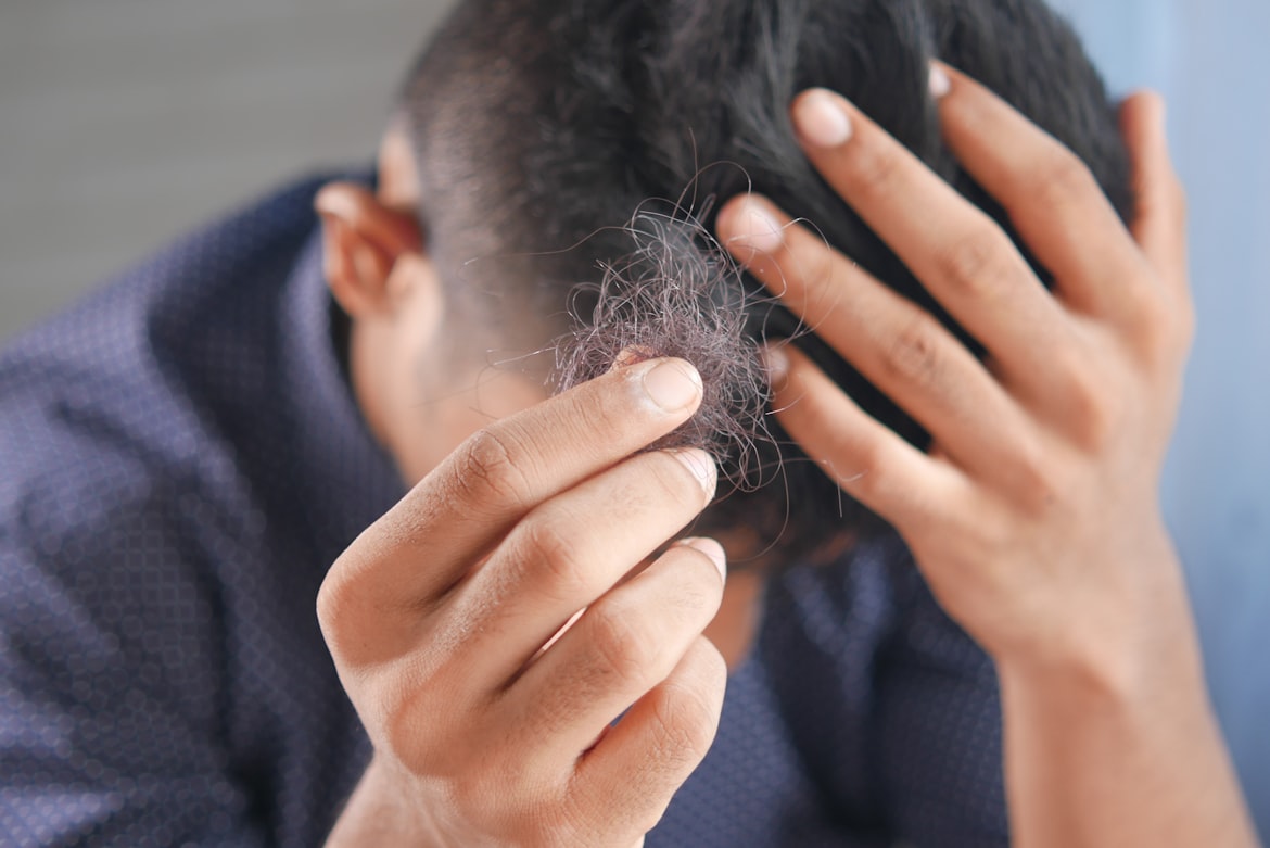 علاج فعّال لتساقط الشعر يحقق نتائج ملحوظة خلال شهرين فقط (أونسبلاش)