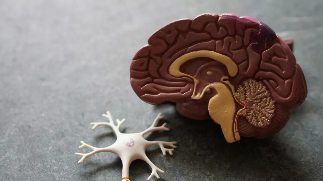 دراسة: 7 علامات مبكرة قد تنذر بورم في الدماغ (أونسبلاش)