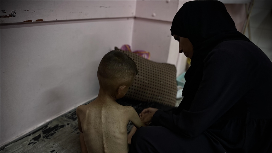 حماس: قرار (العدل الدولية) إدانة لإسرائيل باستخدام التجويع في غزة (الأناضول)