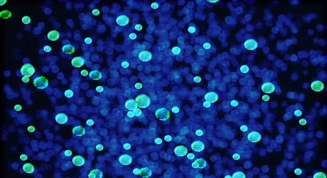 علماء يكتشفون كائنات (تتنفس) الحديد بدلا من الأكسجين (بيكسابي)