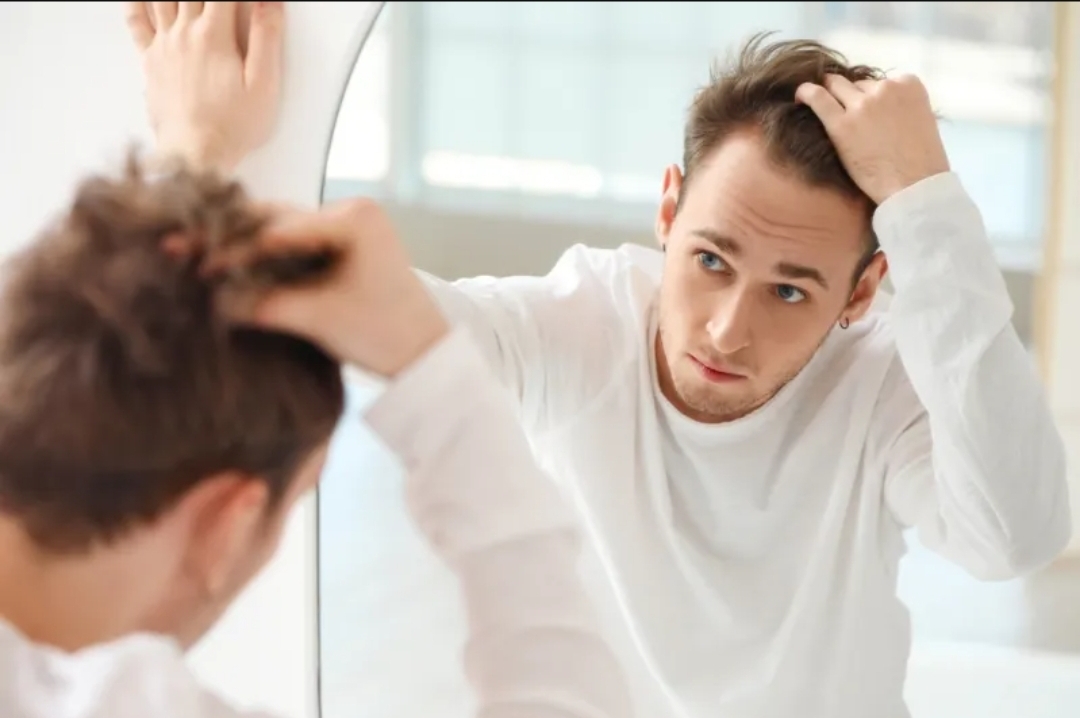طفرة علمية في علاج تساقط الشعر باستخدام مادة طبيعية مستخلصة من الحمض النووي (الرجل)