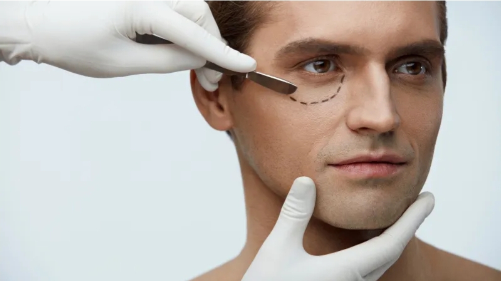 لماذا تتزايد عمليات تجميل الرجال؟ خبراء يوضّحون (الرجل)