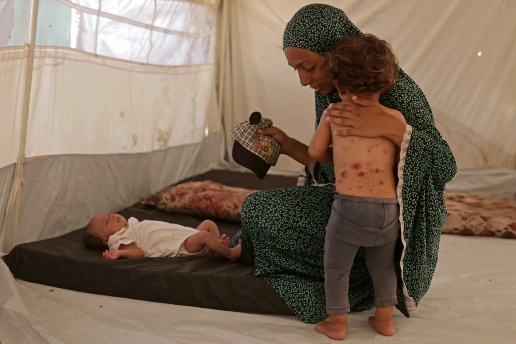 طفلة فلسطينية نازحة تعاني من جدري الماء بالقرب من والدتها في خيمة في خان يونس في جنوب قطاع غزة في 19 تموز/يوليو 2026 (ا ف ب)